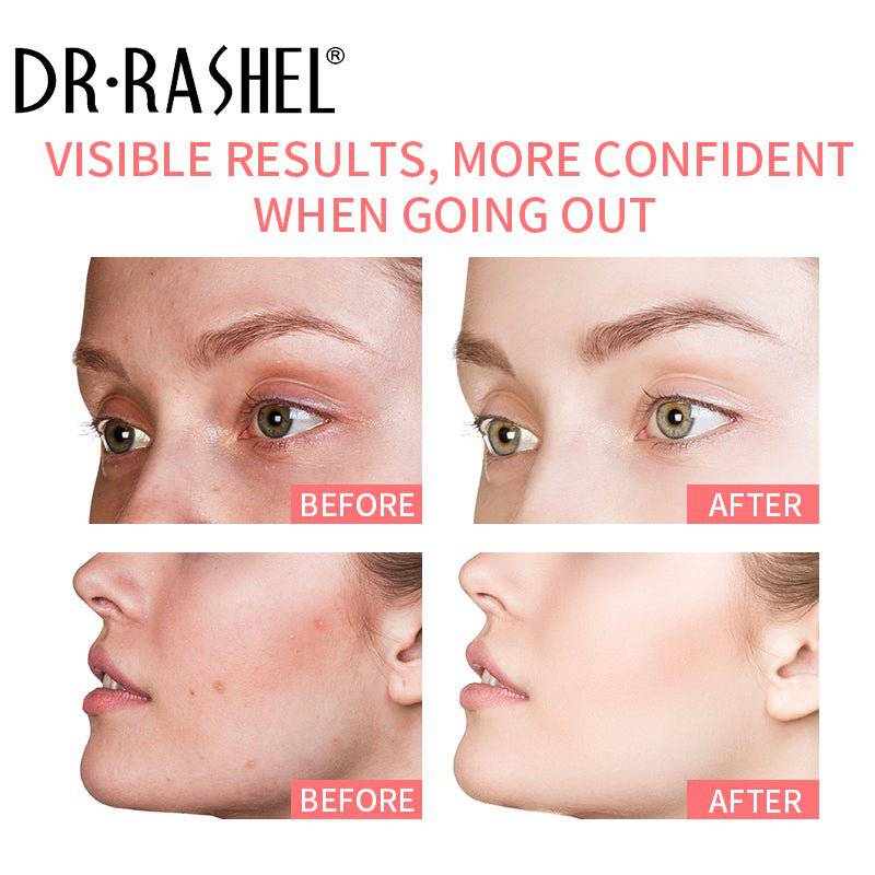 DR RASHEL Whitening Complex Pink Mineral Clay Mask Stick Skin Care - Dr-Rashel-Official